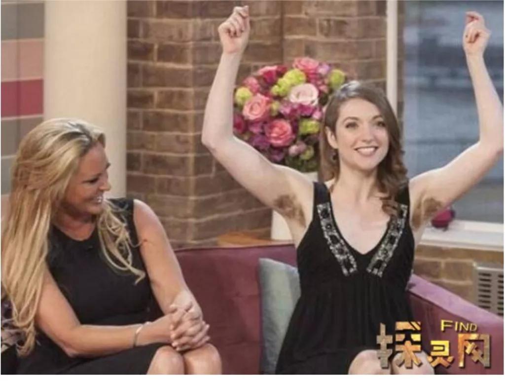 Emily Susan, the woman with the longest body hair in the world iMedia