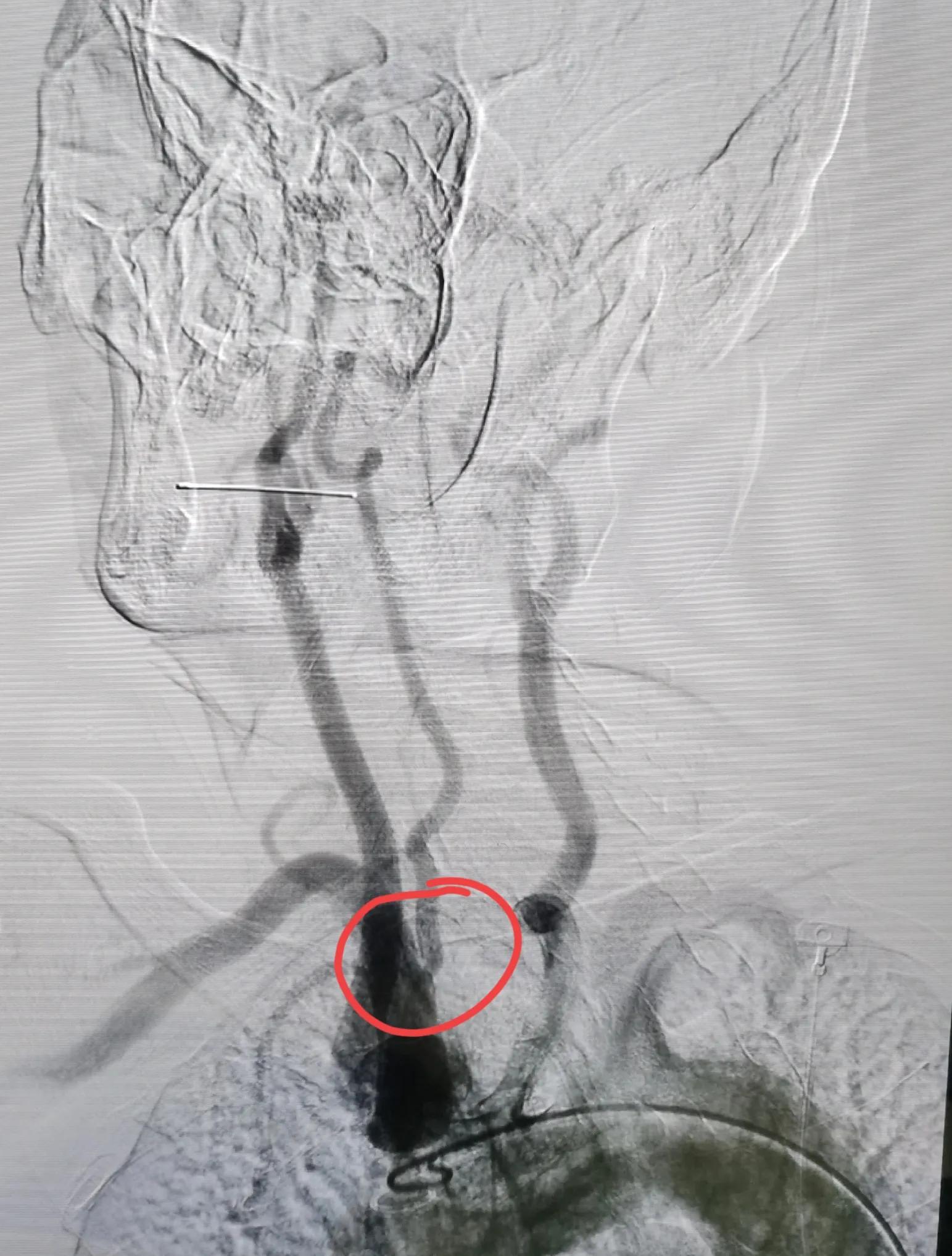 Dizzy Vision Example Consultation of a patient with dizziness and blurred vision - iNEWS