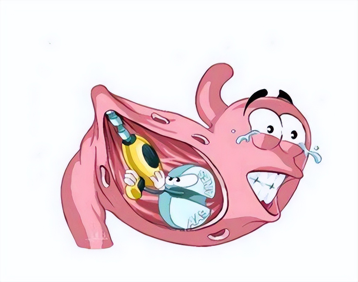 Take you to understand gastric perforation - iNEWS