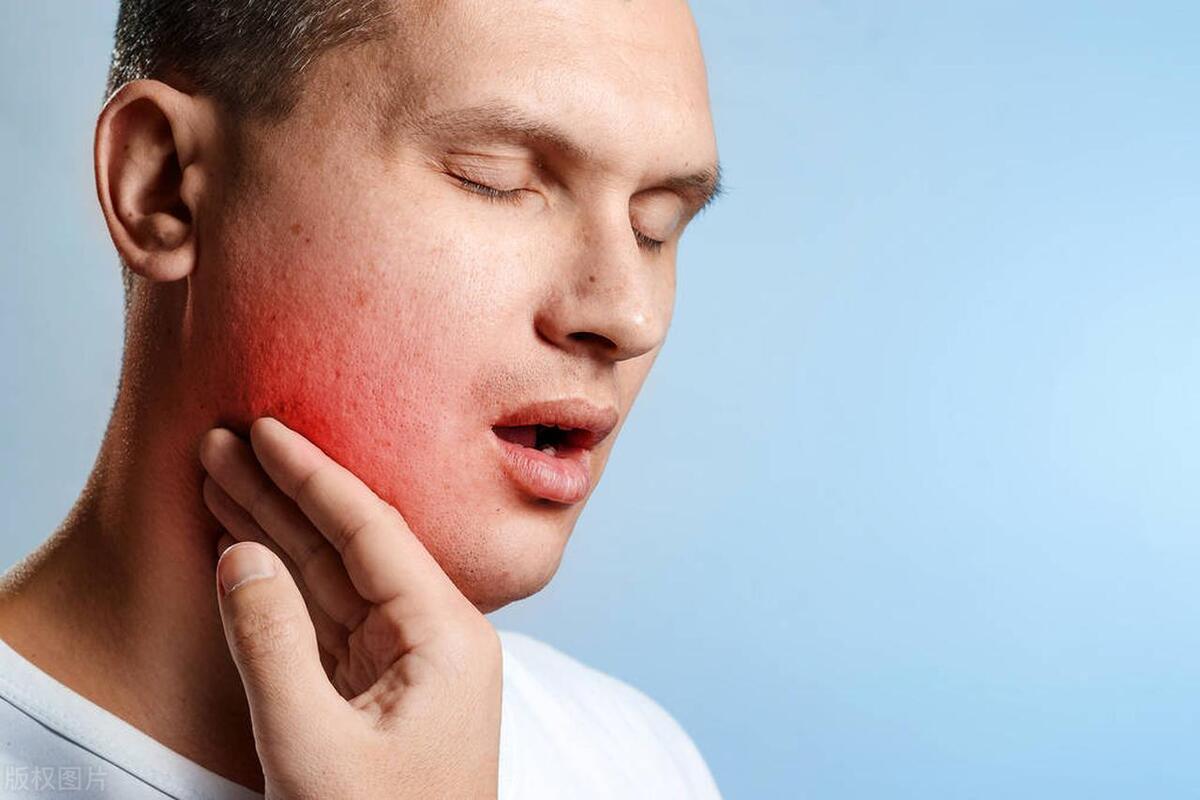 Pay attention to these kinds of oral diseases 7 out of 10 people have