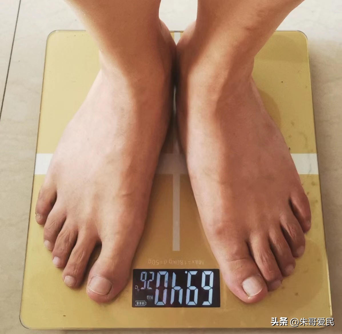 After losing weight successfully, my knee suddenly hurts. After the accident, my cranky thinking