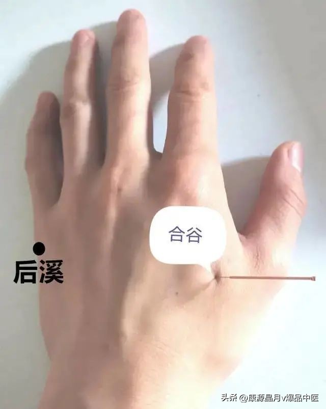 Acupuncture for hand dysfunction after stroke (collector's edition) iNEWS