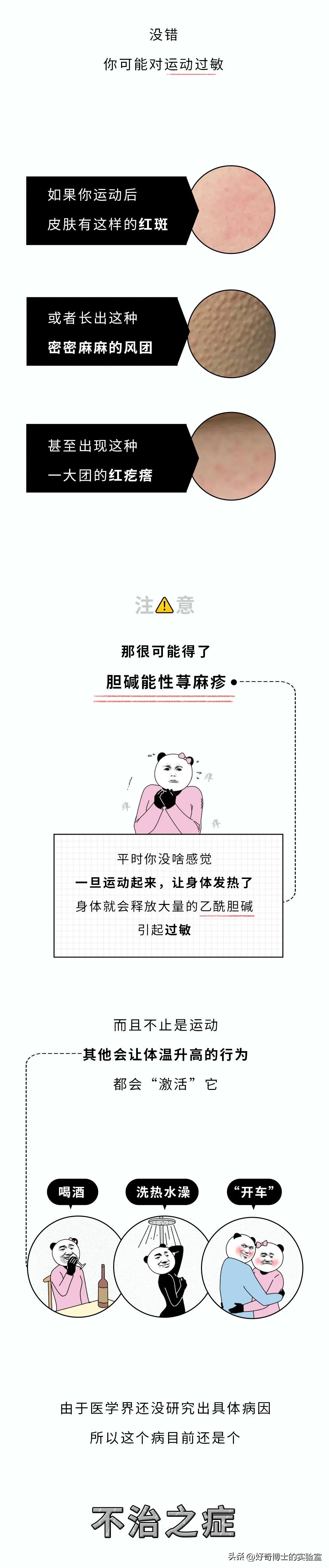 Itching after bathing or exercising, why? iNEWS