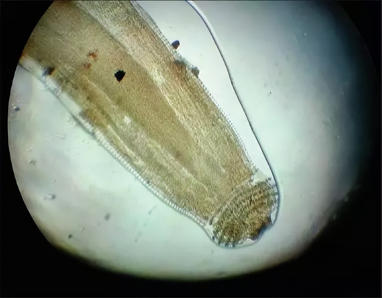 100degree boiling water boils undead parasites, jawstomach nematodes