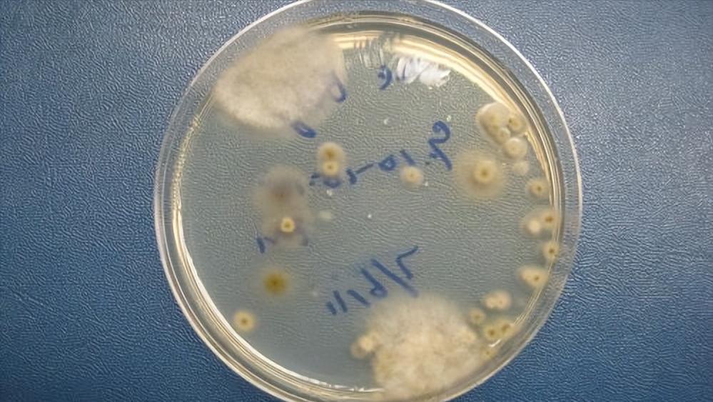 Are walnuts the "hair" of liver disease?Reminder If you want your