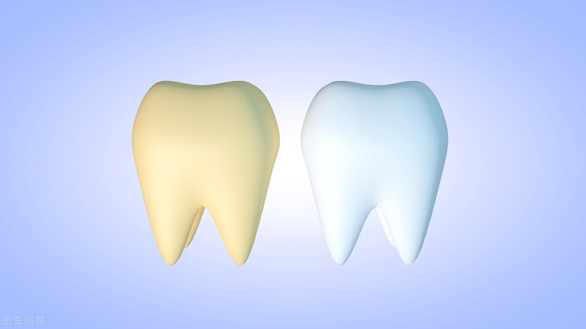 What causes yellow teeth?How can I make my teeth whiter?the dentist