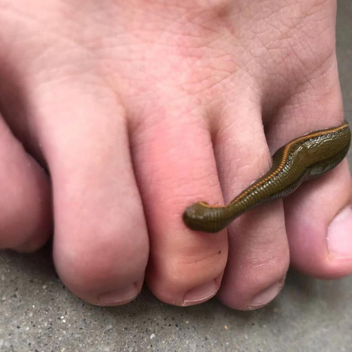 Are ugly leeches harmful to humans? After accidentally swallowing a