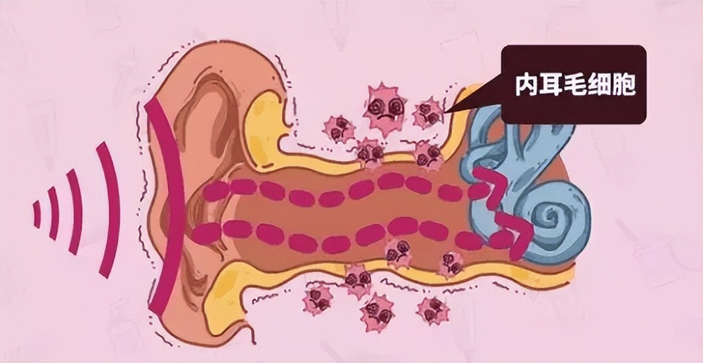 Is it dangerous to use headphones every day?The dangers of overusing