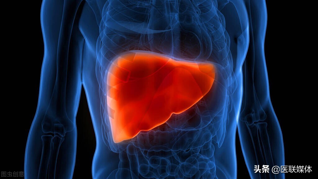 What is liver calcification?It may be related to these 4 reasons, and