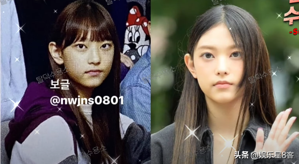 newjeans plastic surgery Image 1