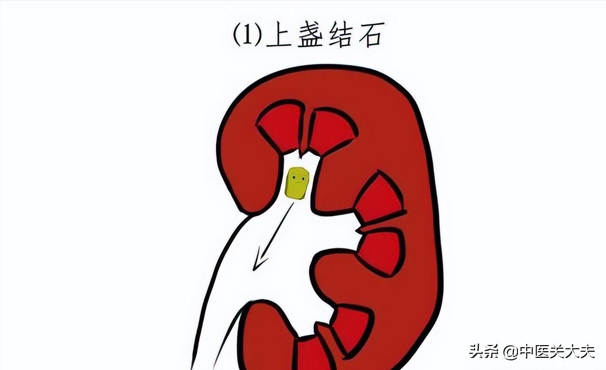 Riding a roller coaster, skipping rope, drinking water, how do you get