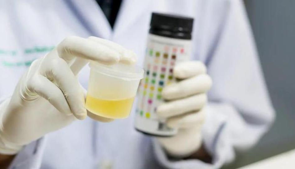 Popular Science What's the matter with foam in urine? iNEWS