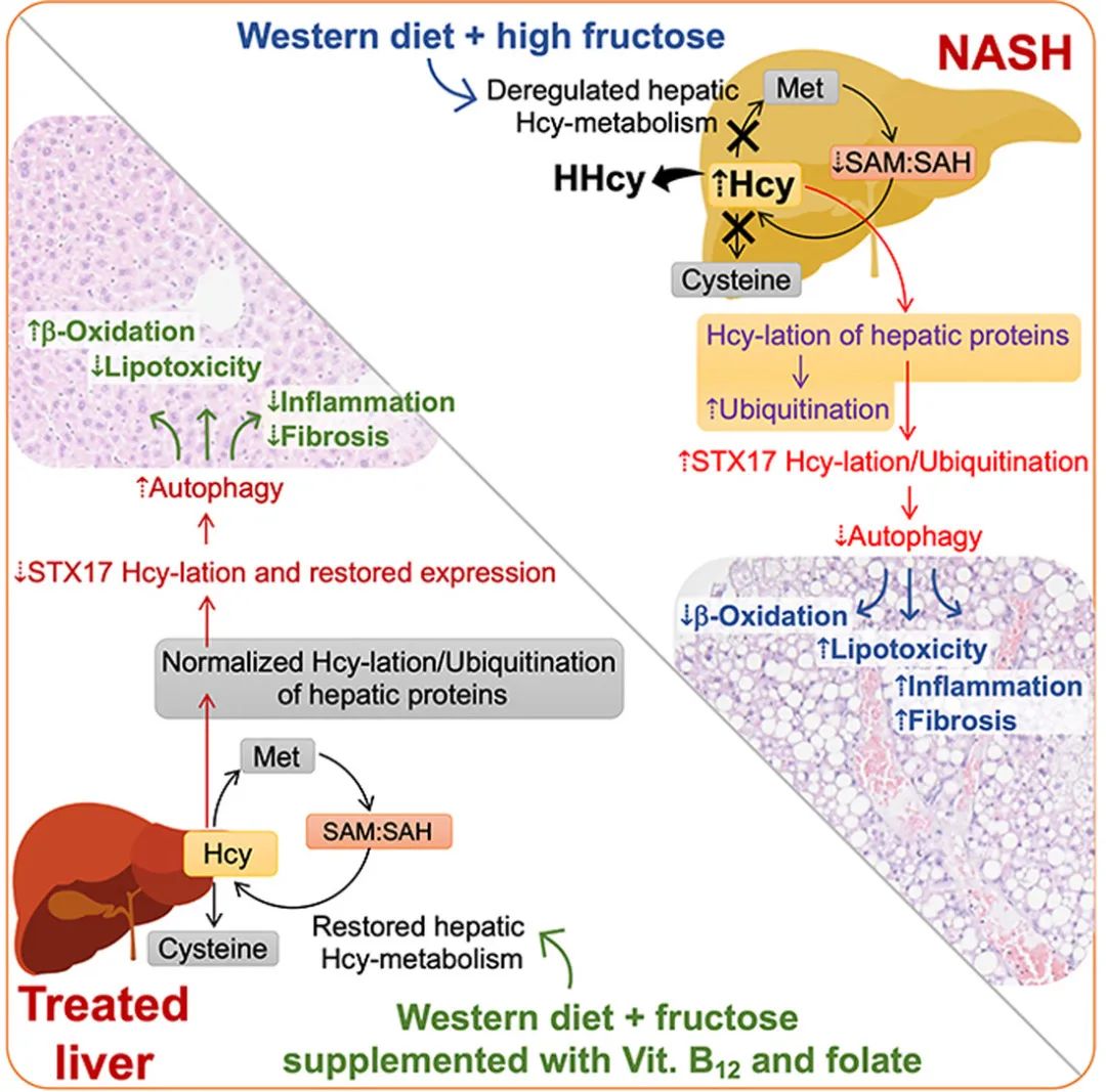 New study finds vitamin B12 and folic acid may help in the treatment