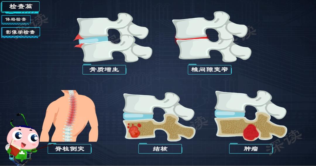 How to do lumbar disc herniation? Massage? massage? Or surgery? Count