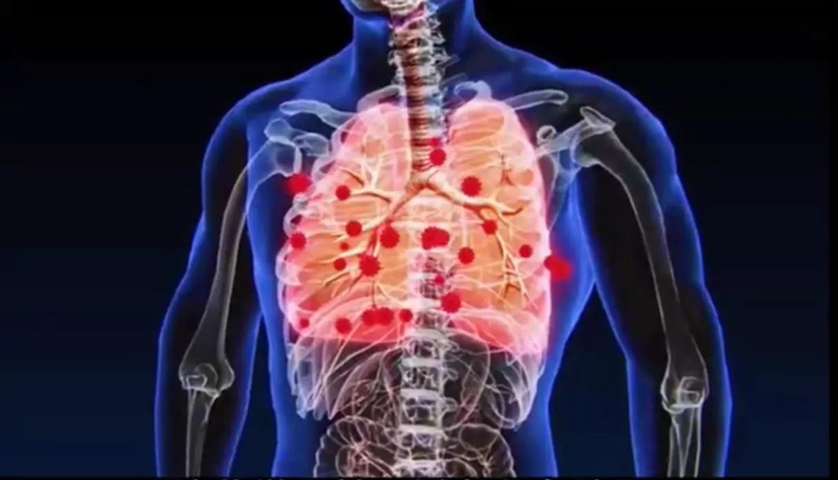 Do you know how mosquito coils work? iNEWS