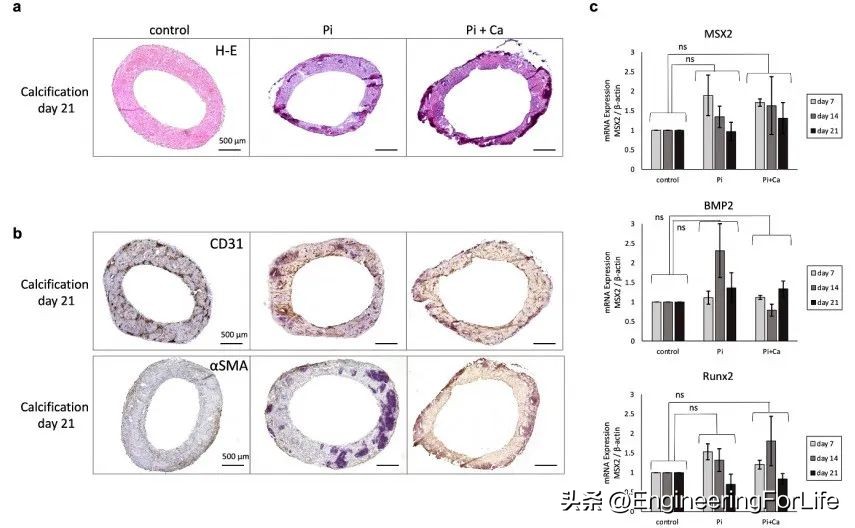"Biofabrication": 3D printing scaffold-free human vascular ...