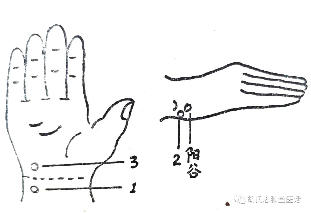 How many Shenmen acupuncture points are there? iNEWS