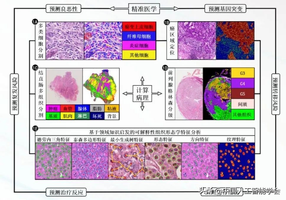 Computational pathology and its contribution and value to precision ...