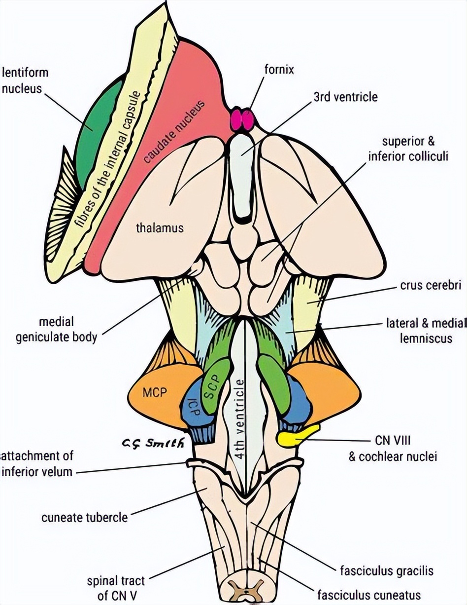 Why is cerebellum-brain stem surgery so risky?10 major postoperative ...