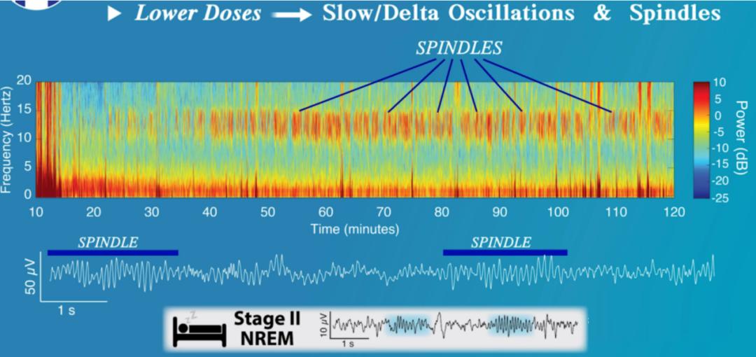 The application of EEG monitoring in the perioperative period, with the ...