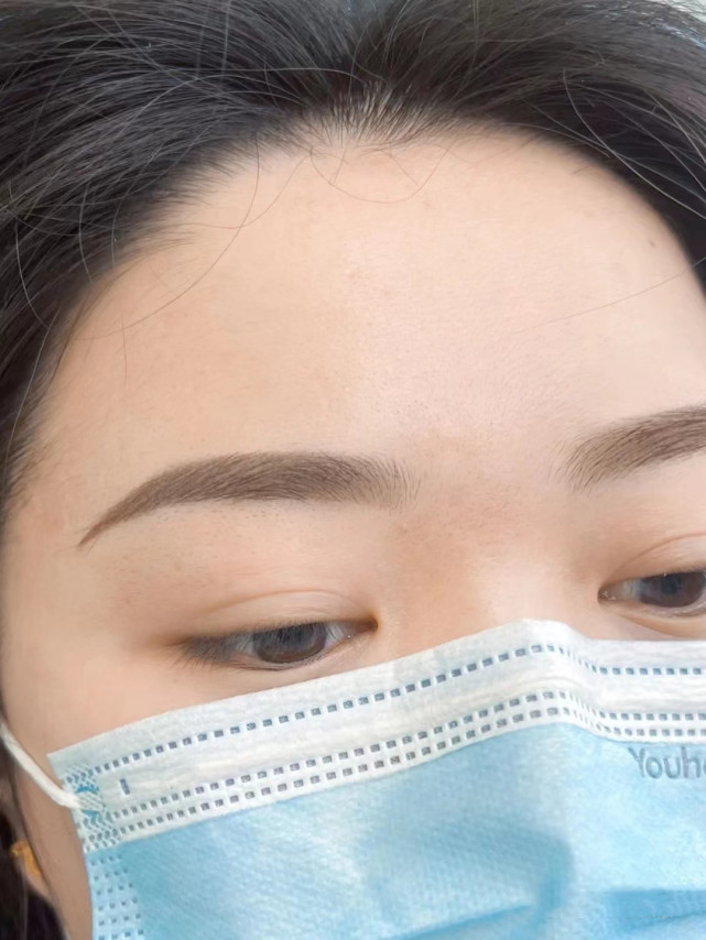 What are the causes of red eyebrows? iNEWS