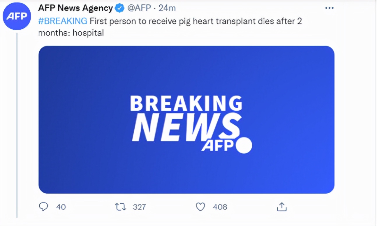 Man who received 'pig heart' transplant died after two months... iNEWS