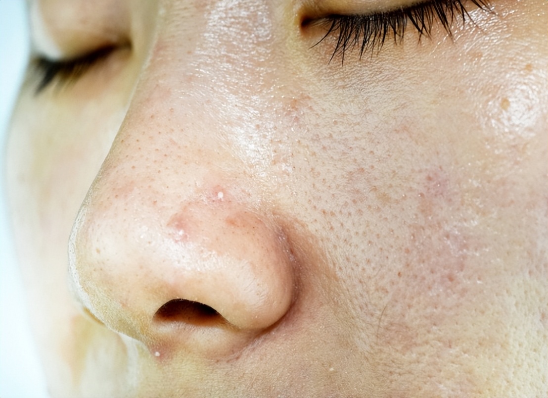 Antioxidant power 6000 times stronger than vitamin C?How does