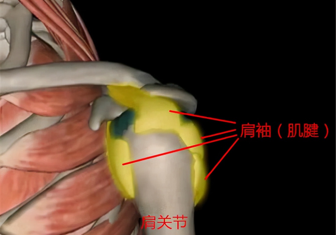 What is the difference between frozen shoulder and rotator cuff tear iNEWS