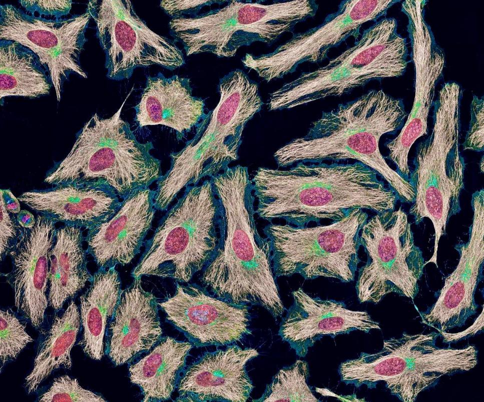HeLa cells: People are dead, but cells are still alive. So far, they ...