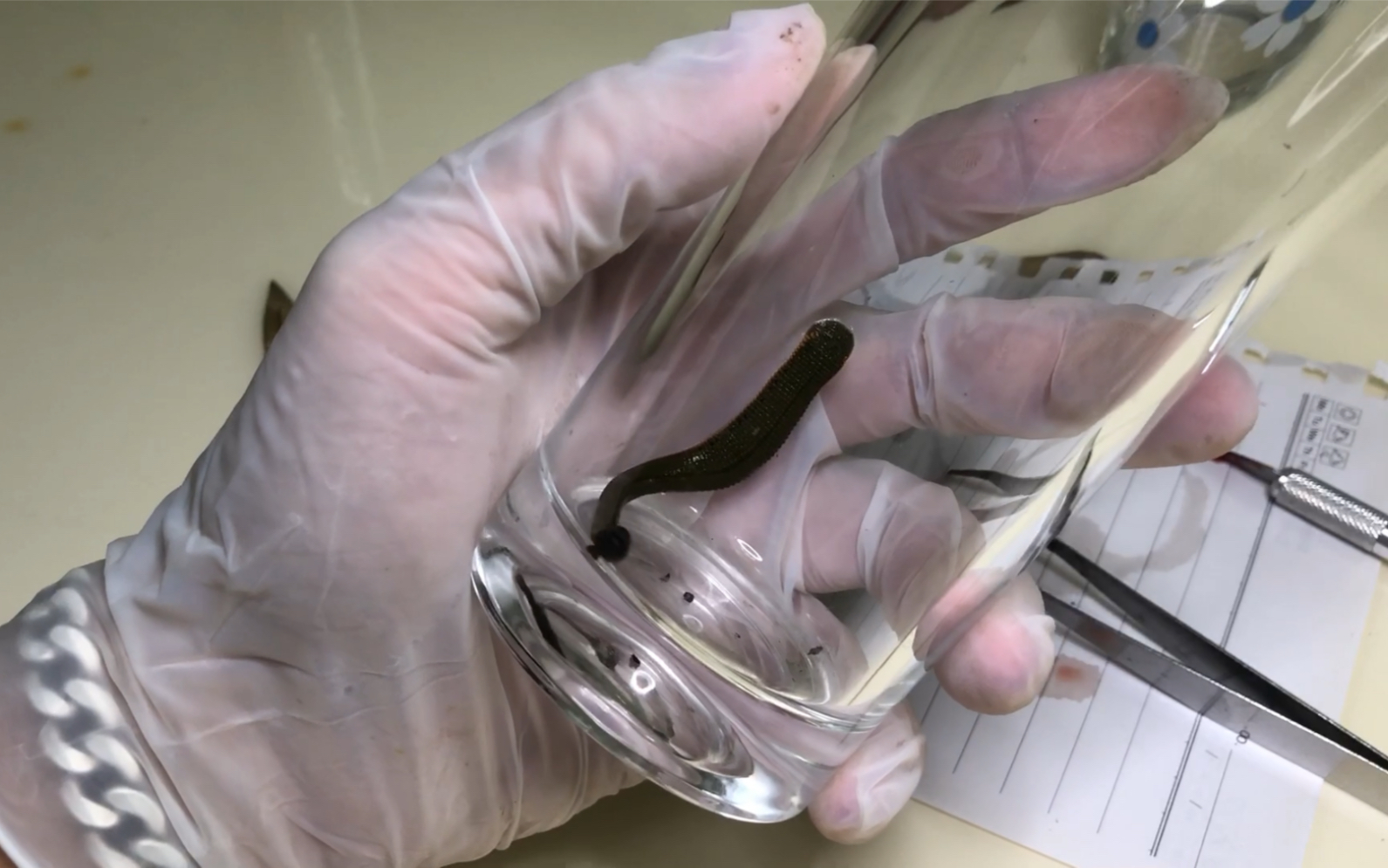 Are ugly leeches harmful to humans? After accidentally swallowing a