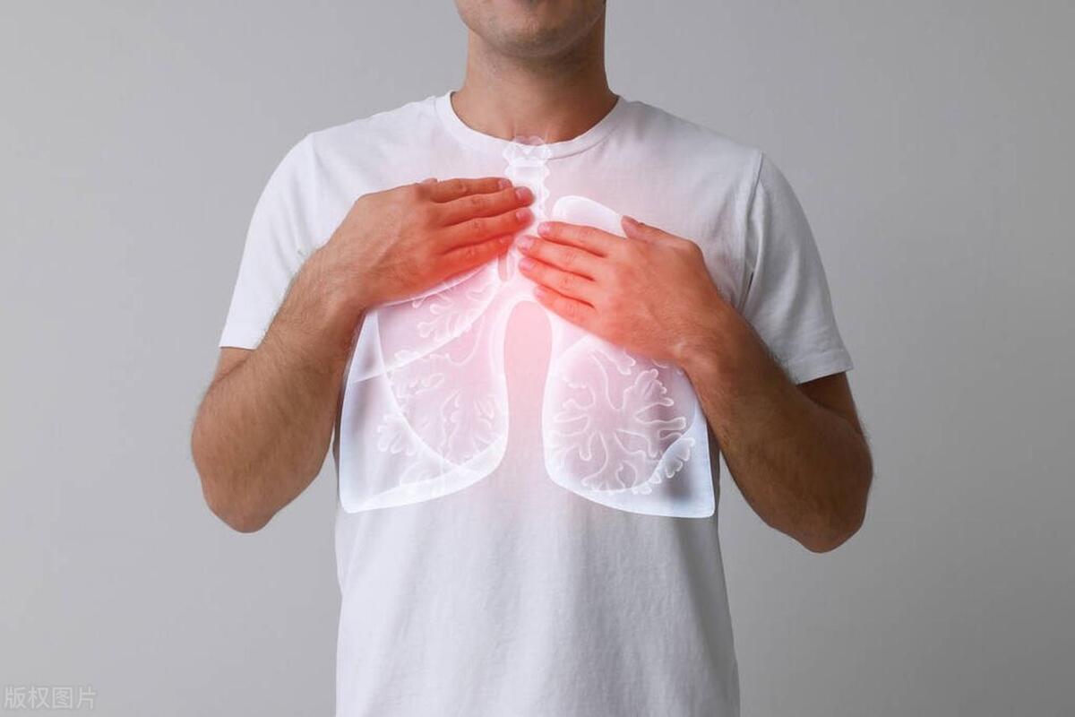 Why is lung cancer recurring easily? Do these 4 things well after ...