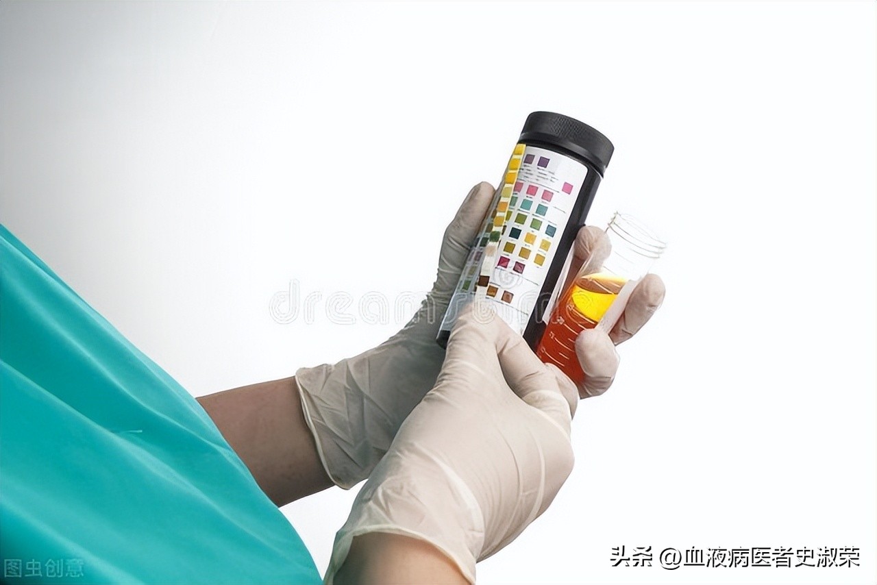 Urinary occult blood appears during the treatment of allergic purpura