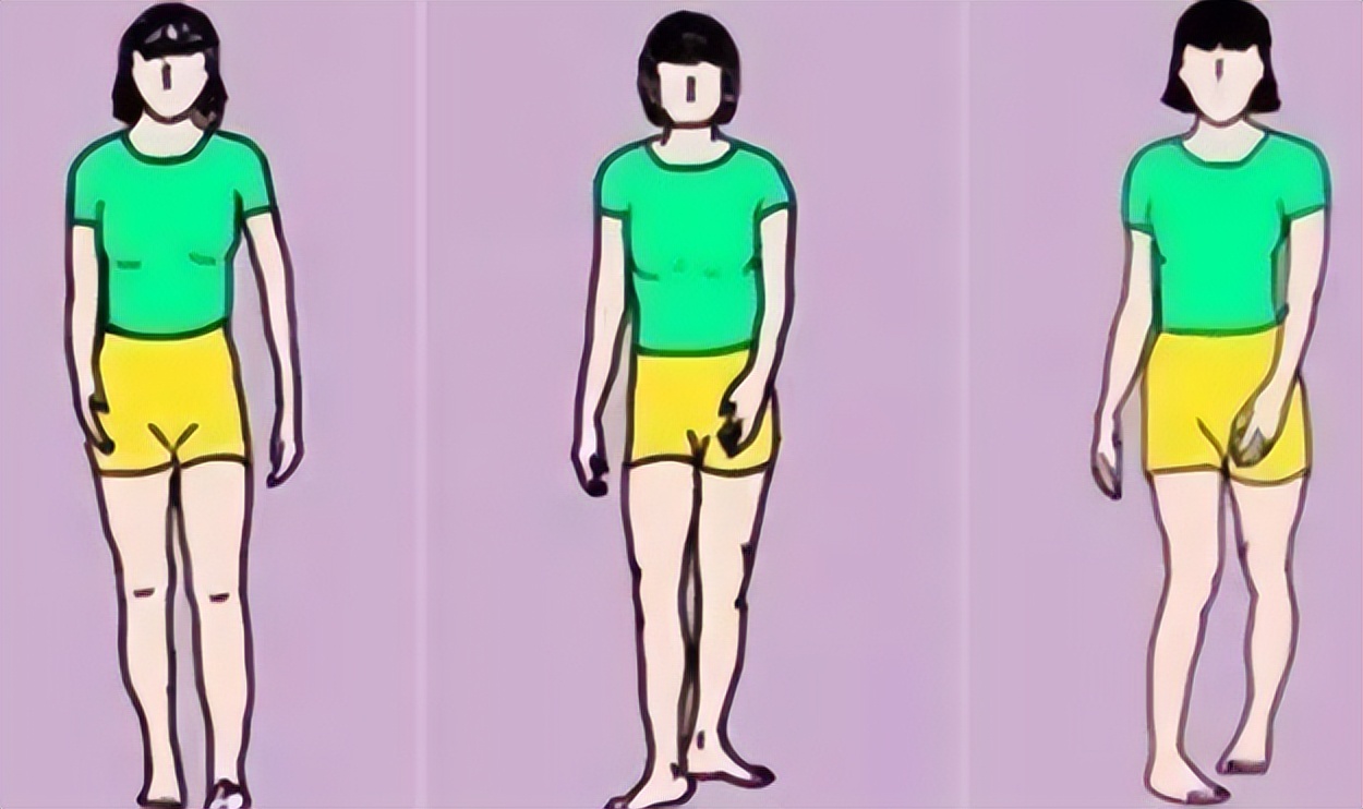 How to exercise by walking without hurting your knees?Doctors tell you