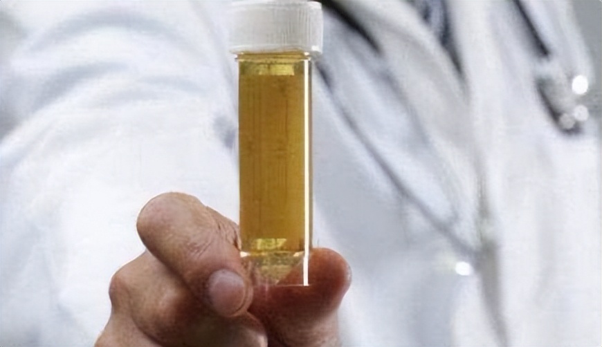 Can bitter gourd lower uric acid? Doctor These 5 kinds of food are