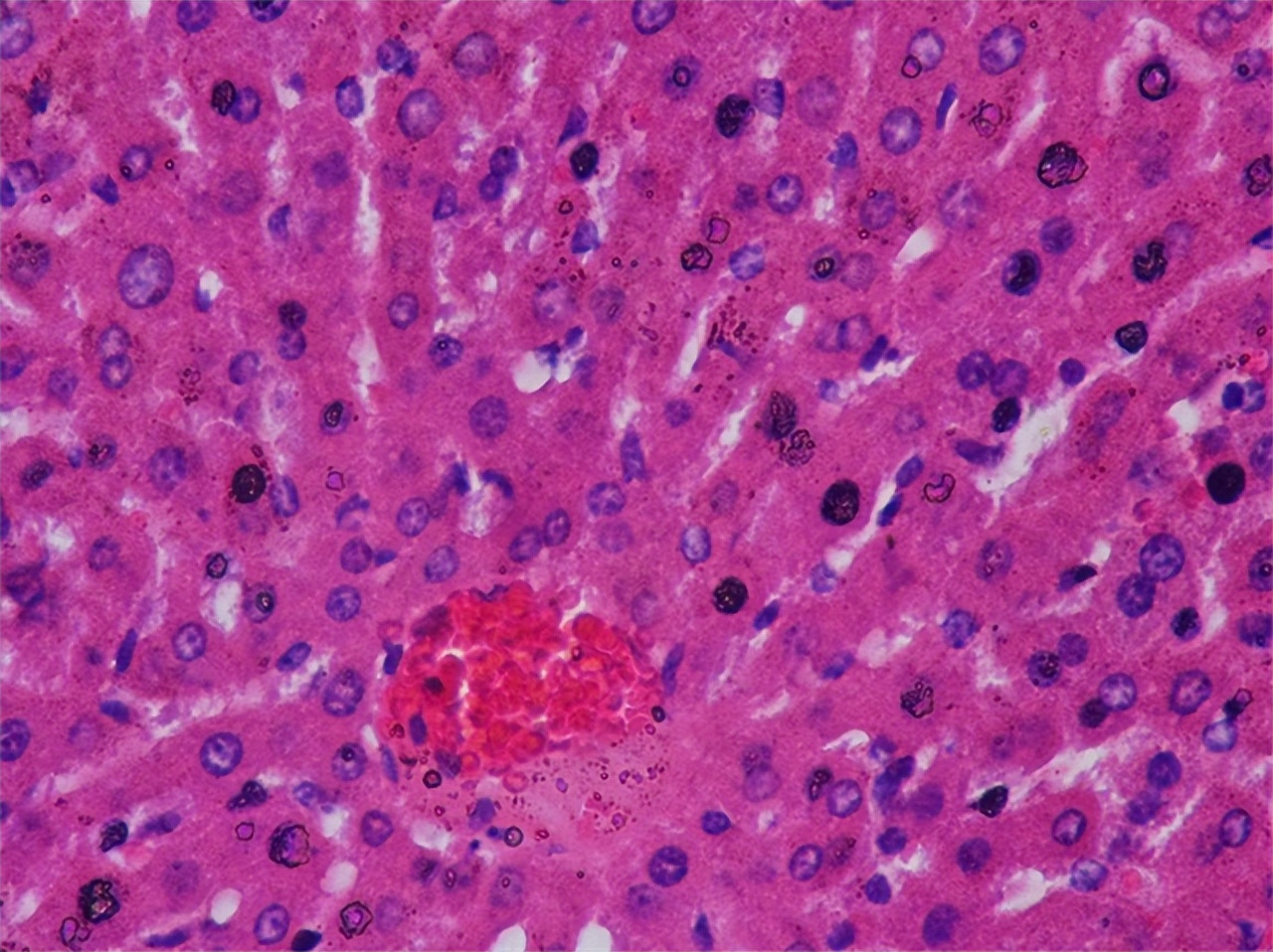 Research progress of interleukin-1 family cytokines in liver diseases ...