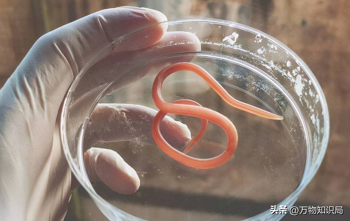 A few decades ago, almost everyone had roundworms in their stomachs ...