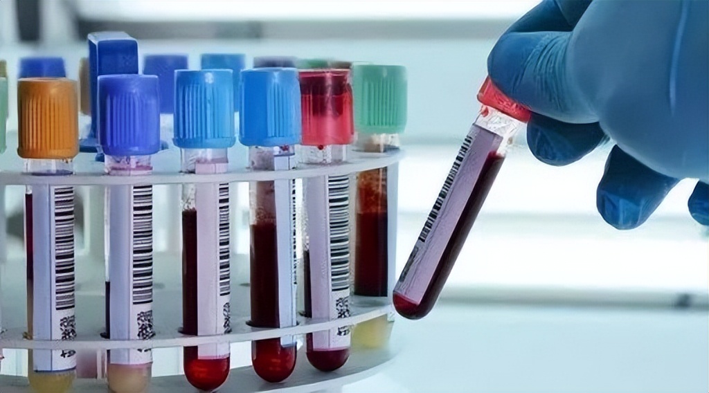 The purpose of drawing blood at each stage in the test tube, 90 of women do not know its role