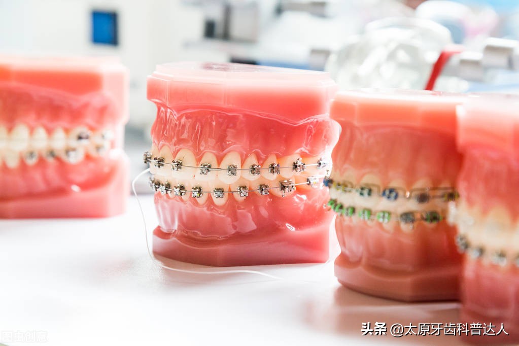 What problems can misaligned teeth cause? iNEWS