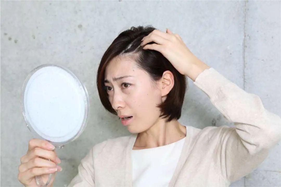 What vitamin deficiency can cause gray hair?How to prevent gray hair from appearing? iNEWS