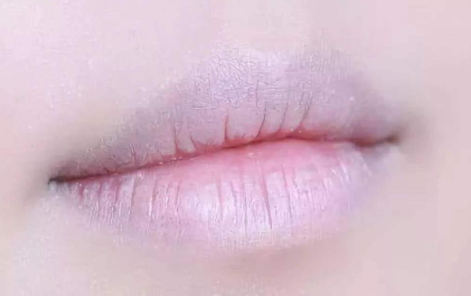 Lips Health Color Look at lip color, know health: lips are the barometer of the body ...