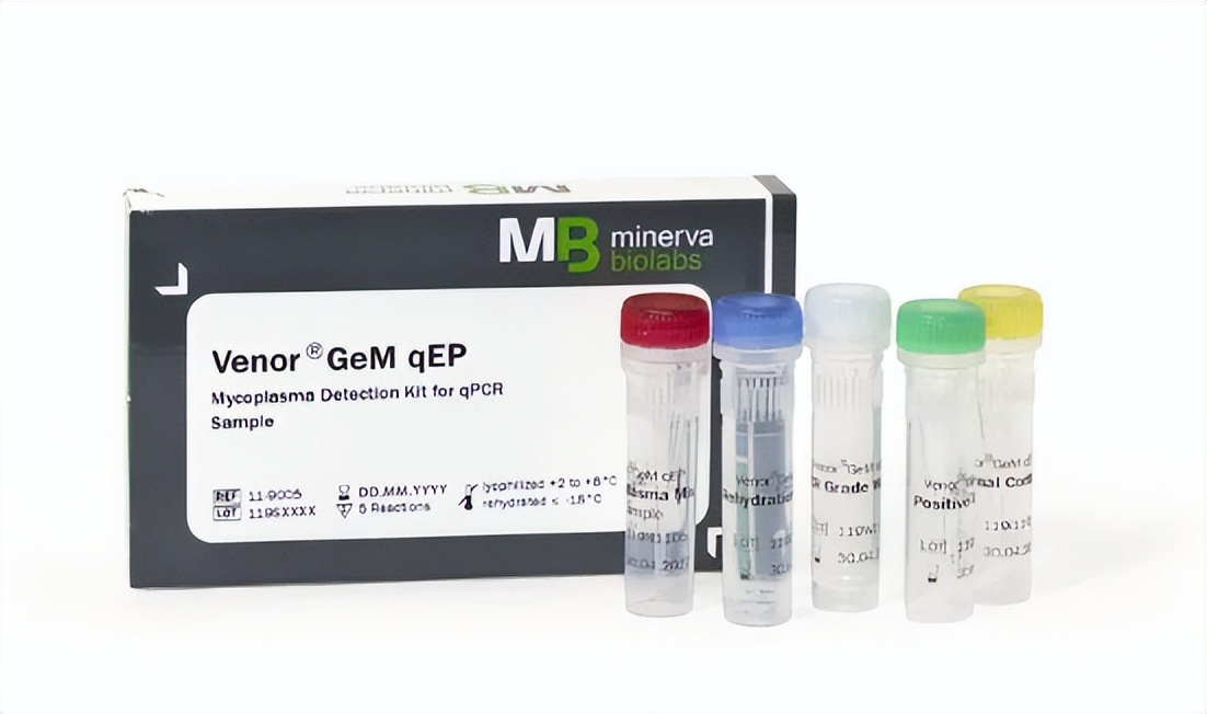 How to quickly detect mycoplasma contamination in cell culture iNEWS