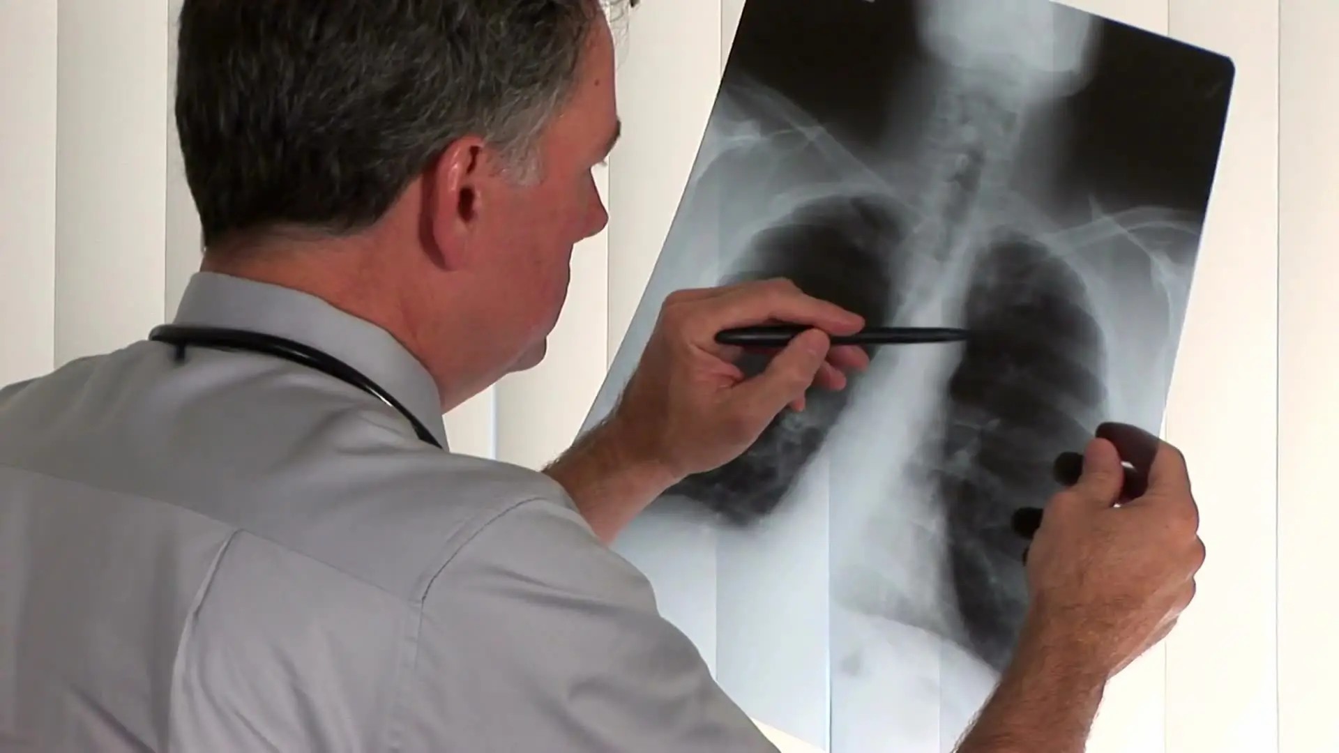 Why are MRIs so expensive?Hundreds of thousands are required to do it