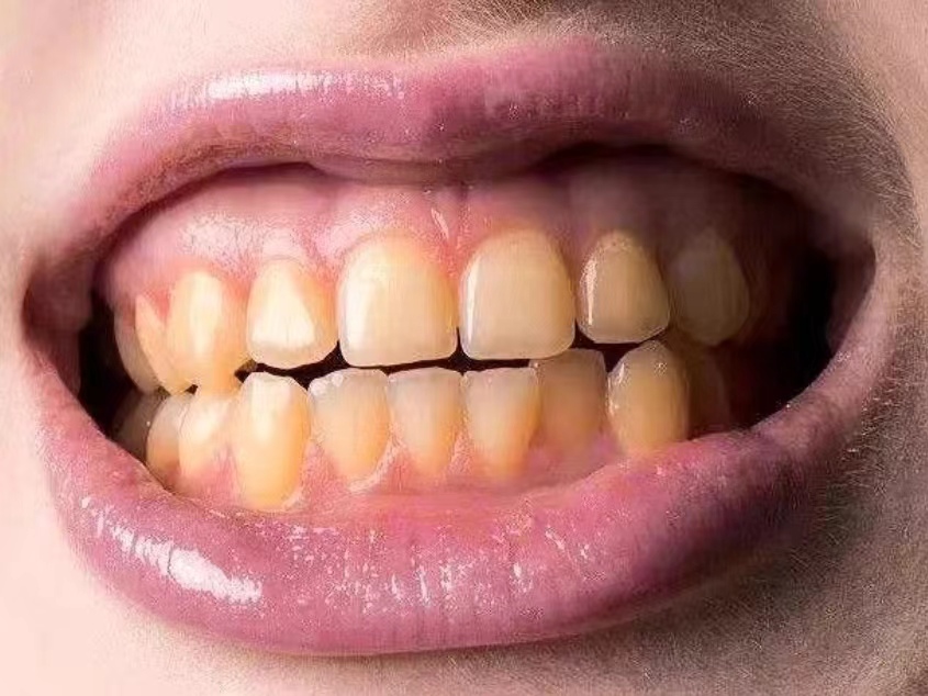 Science Popularization by Dentists] The most effective way to