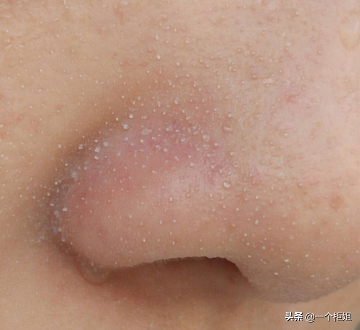 The pores on the nose are large, and yellow millet grains can be