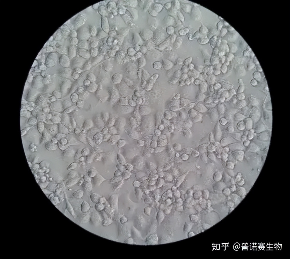 How does THP1 induce differentiation into macrophages and foam cells