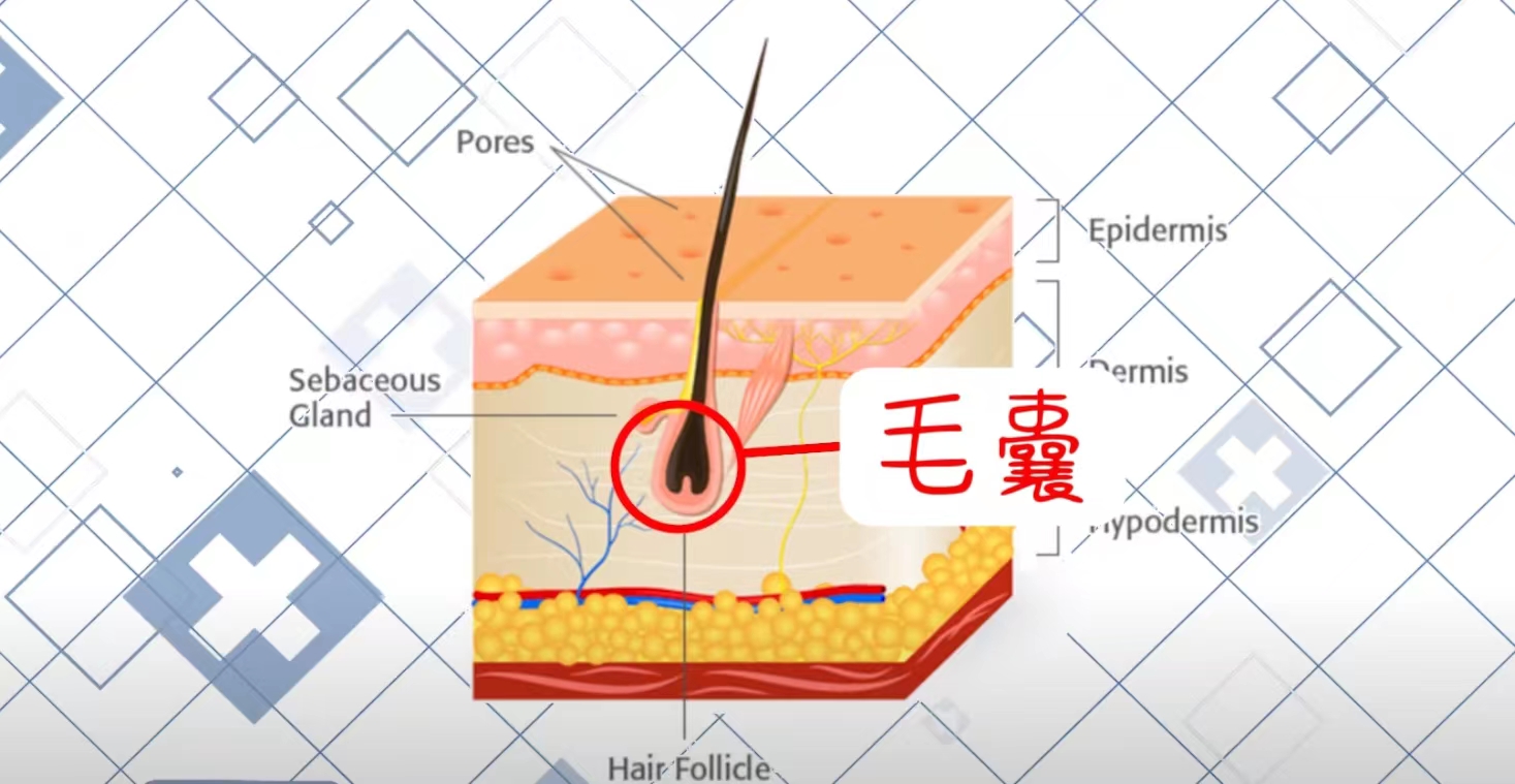 What causes enlarged pores?What are the correct ways to treat enlarged pores? iNEWS