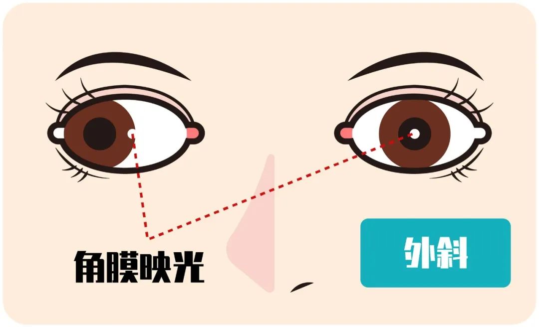 My child is nearsighted, should he wear glasses all the time?Can I