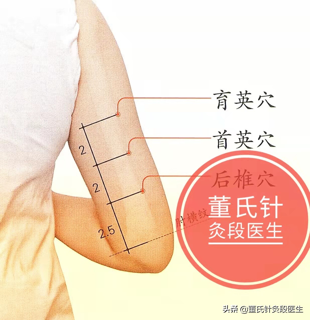 今天分享董氏針灸三英穴,治療慢性支氣管炎的特效穴 - 資訊咖