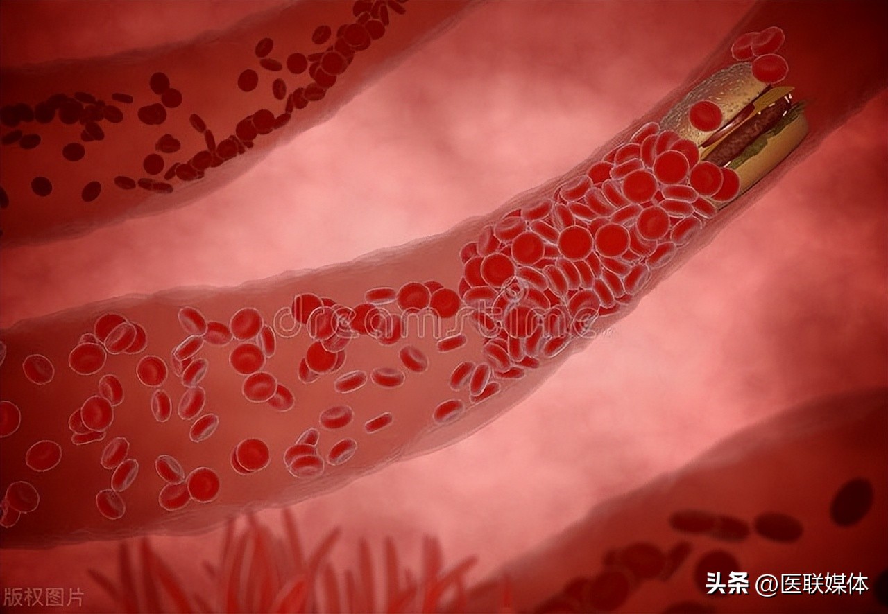 The corn silk that is often thrown away, left to soak in water, has these 4 benefits iNEWS