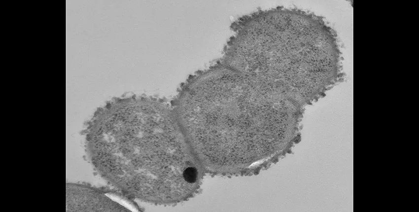 Ruminococcus—Key Bacteria for Digestion and Degradation? Inflammatory ...